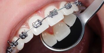 '53 tandartspraktijken gebruiken titel orthodontist verkeerd'