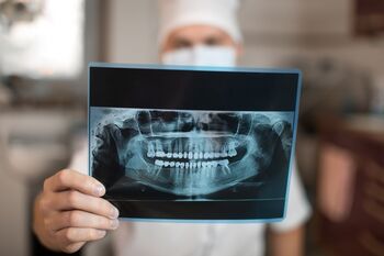 IGZ controleert gebruik röntgenfoto's in de mondzorg