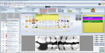 De inhaalslag in tandheelkundige software