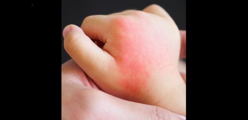 Snel meekijken via Video Connect van Vcare (Foto:Vcare)