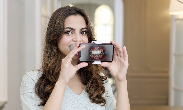 Dental Monitoring