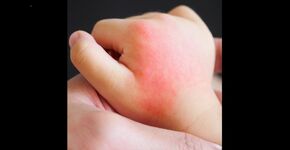 Snel meekijken via Video Connect van Vcare (Foto:Vcare)