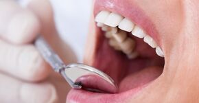 Bloedtest voor tienduizenden Britten door "vieze tandarts"